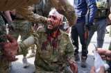 Grave situación en Siria: casi 250 muertes por combates con milicias pro Al Asad