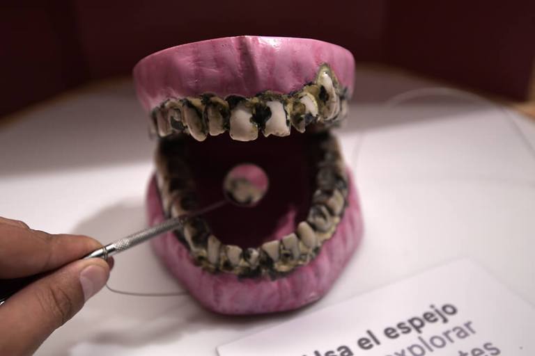 ¡Guácala!: una exposición para morirse del asco