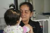 Salvan vida de bebé con malformación cráneo facial