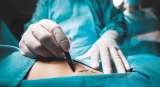 Mujer murió tras practicarse una cirugía estética en Cali: esto se sabe