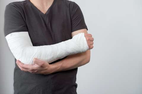 Soñar que me parto un brazo qué significa. ¿Augurio de mala o buena suerte?