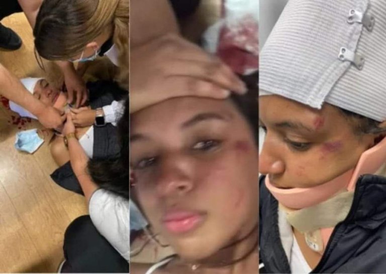 Mujer denuncia fuerte golpiza de un hombre por no ceder la máquina del gimnasio