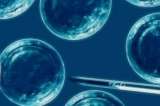 Científicos españoles crean espermatozoides humanos utilizando células de la piel