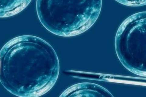 Científicos españoles crean espermatozoides humanos utilizando células de la piel