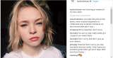 Taylor Hickson, la actriz que terminó desfigurada en rodaje de película de terror
