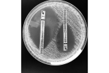 Otra señal para pararle bolas al hongo Candida auris