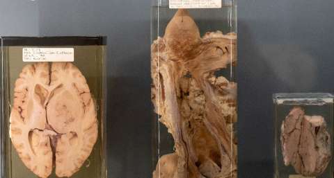 Una exposición en Viena pone a prueba la ética de la exhibición de restos humanos