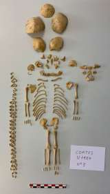 Identifican síndrome de Down en bebés de hace 2.600 años a través de su ADN