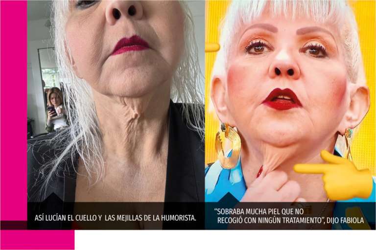 Así fue la transformación de la gorda Fabiola