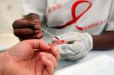 Identificar esta proteína en la sangre facilitaría la detección de VIH en el mundo