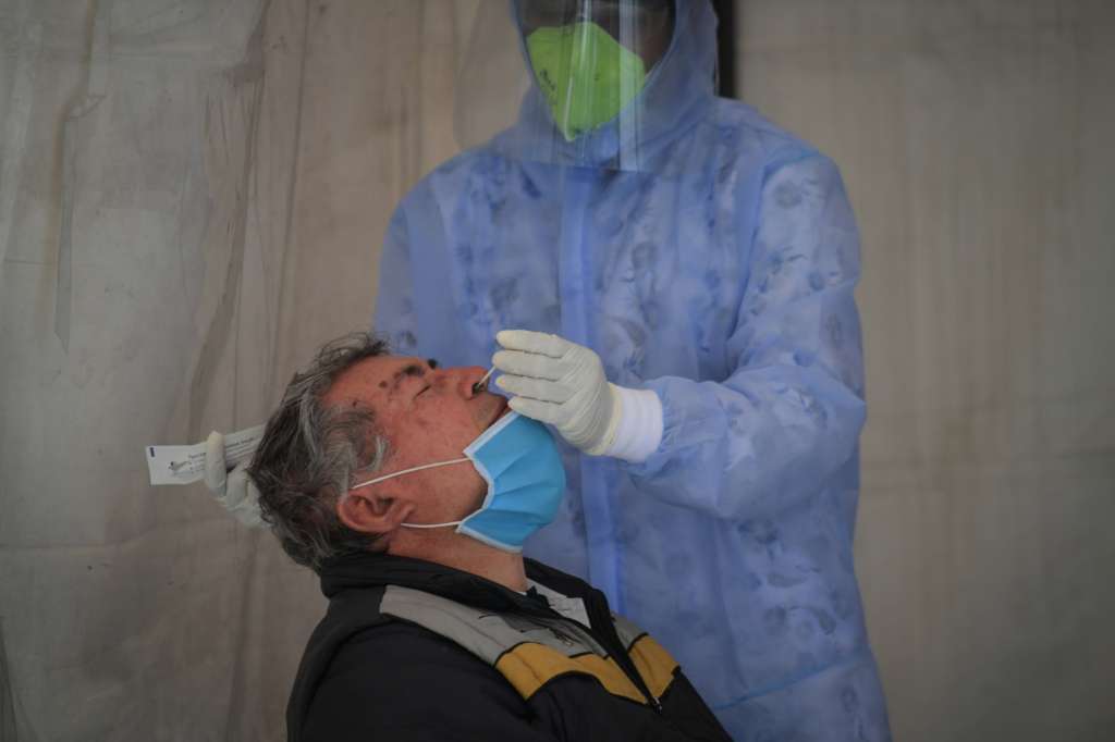 Pruebas para la detección del Coronavirus Covid – 19