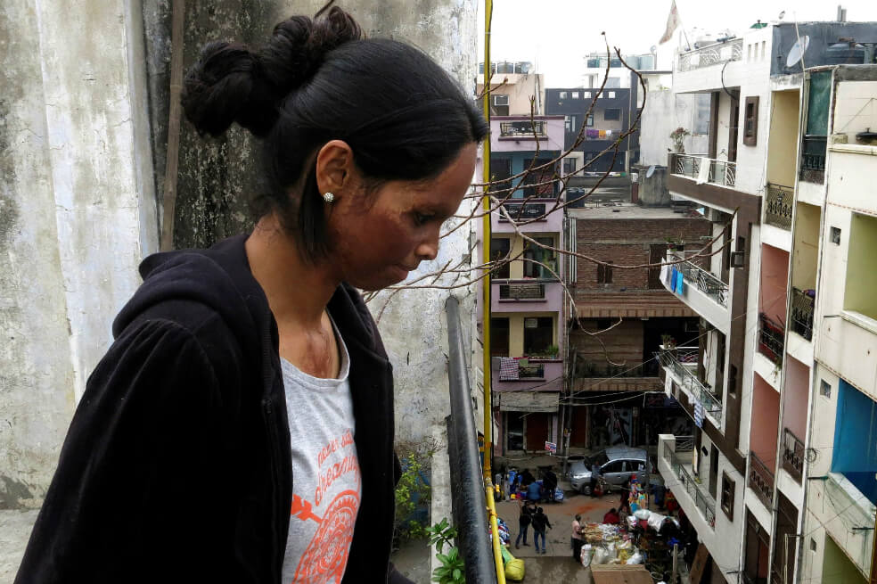 Laxmi Agarwal tenía 14 años cuando sufrió un ataque con ácido. / EFE