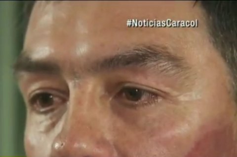 Hombre atacado con ácido exige justicia y atención médica