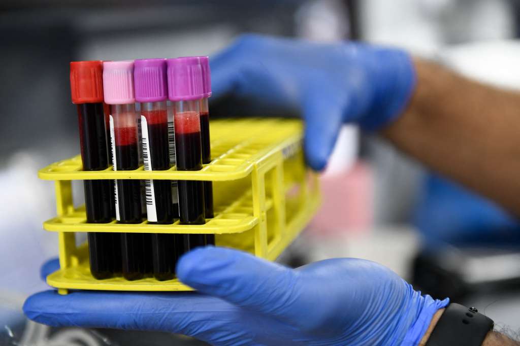 El estigma que viven las personas LGBT al donar sangre podría llegar a su fin