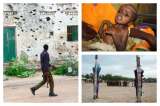 Impactantes imágenes de desnutrición y crisis social en Somalia