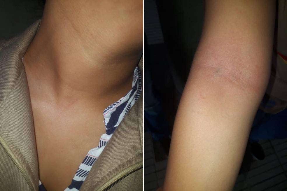 Durante las últimas dos semanas de septiembre se han presentado cinco casos de maltrato físico contra los guías del programa SúbeT. De acuerdo con Transmetro, entre los maltratos propinados por algunos usuarios, que no pagan el pasajeni respetan el turno en la fila, se encuentran los puñetazos, empujones, rasguños, cachetadas y jaladas de cabello.