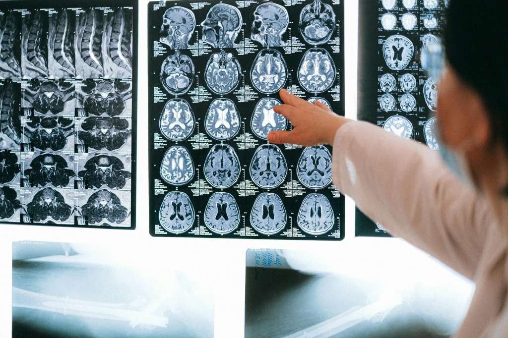 Exámenes de cerebro