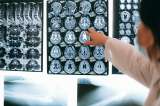Científicos trazan el primer mapa de cómo cambia la organización del cerebro durante la vida