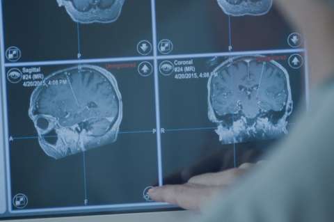 El sueño no eliminaría las toxinas del cerebro como se creía