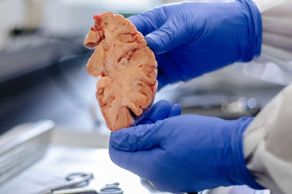 Francisco Lopera, coordinador del Grupo de Neurociencias de Antioquia, de la Udea.