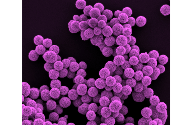 "Imágenes de microscopio electrónico de barrido de nanopartículas de oro mesoporosas", escribió el Instituto.