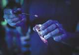 Tusi, dedos morados y riesgo de amputación: los casos que desconciertan a los médicos