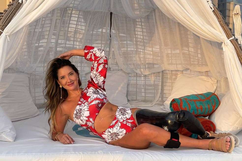 Hace dos años, Daniella Álvarez sufrió la amputación de su pierna izquierda. Así ha enfrentado uno de los momentos más duros de su vida.