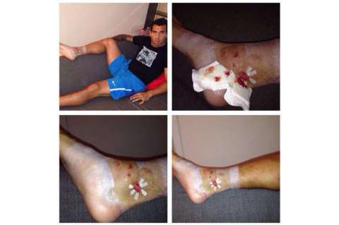 Tévez mostró las secuelas de una brutal patada