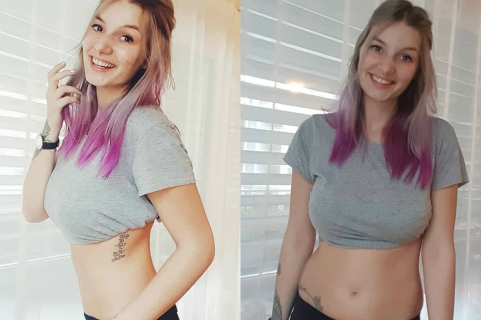 La instagramer quiere desvirtuar estereotipos y tiene 9.000 seguidores. / Cortesía: Instagram - @the_truth_is_not_pretty
