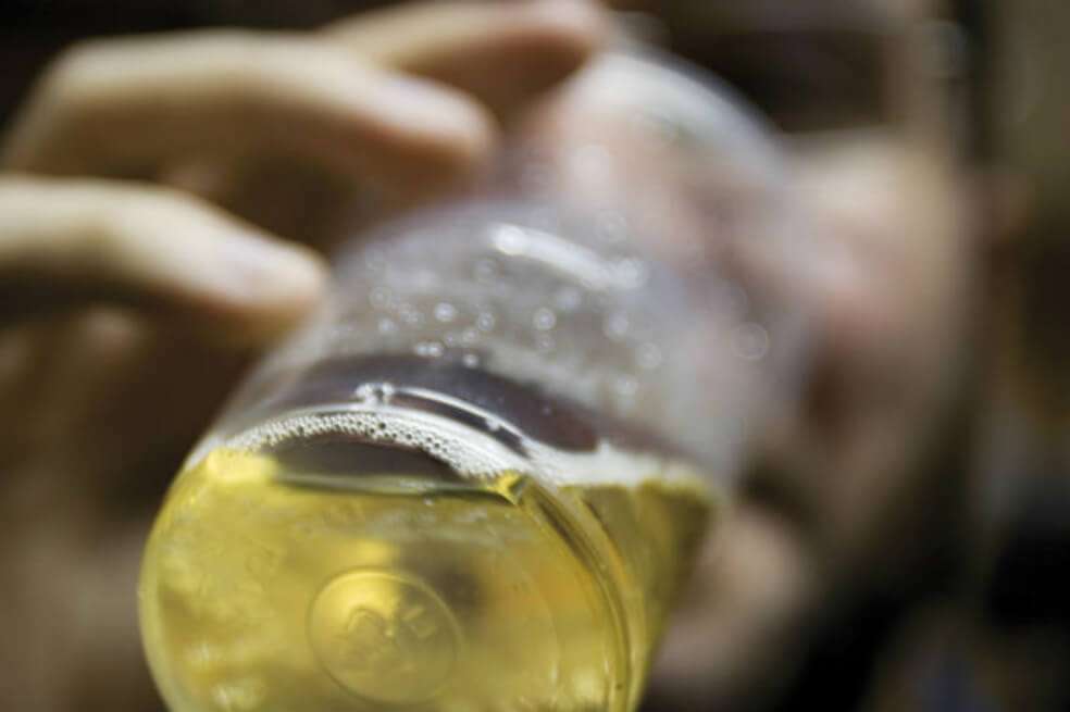 Seis semanas después de haber dejado de beber siguen produciéndose cambios en la materia blanca del cerebro. / SINC