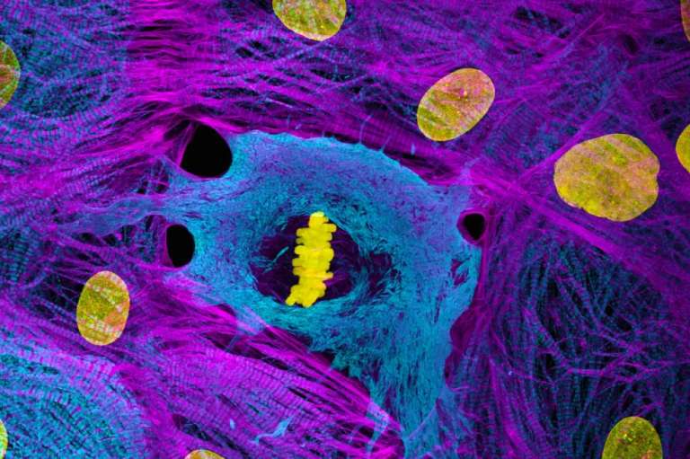 Dr. James Hayes ocupó el décimo puesto. En su foto se observan las células del músculo cardíaco (derivadas de iPSC) que muestran cromosomas condensados en metafase.
