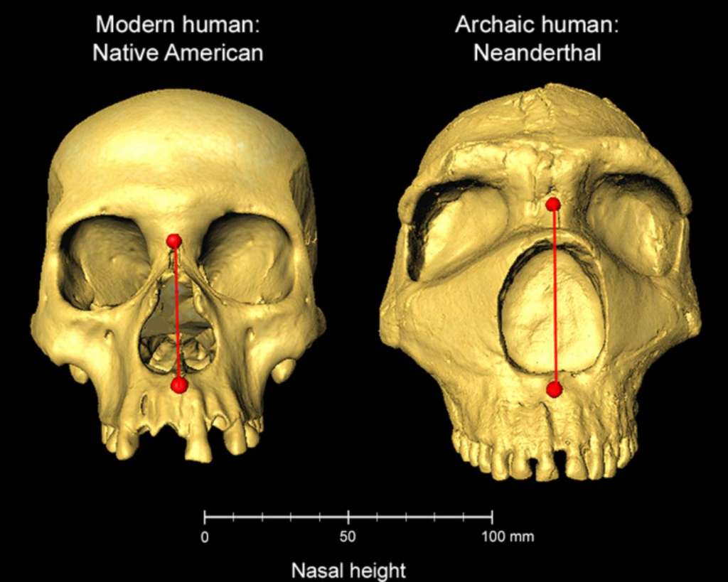 Los portadores de material genético neandertal tienen una mayor altura nasal. / Kaustubh Adhikari (UCL)